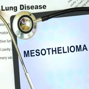 asbestos and mesothelioma lawsuits new orleans louisiana